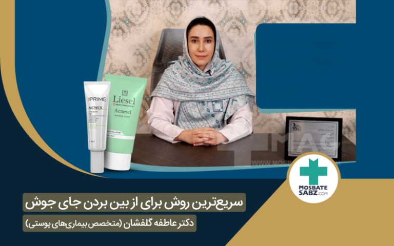 از بین بردن جای جوش مصاحبه با دکتر گلفشان