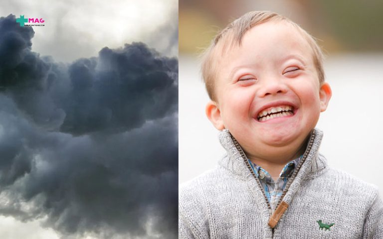 رابطه آلودگی هوا و سندرم داون