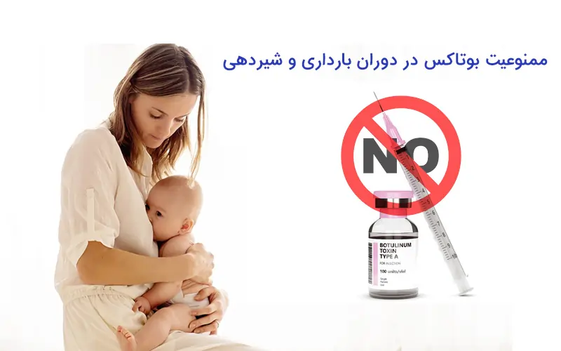 تزریق بوتاکس برای مادران شیرده