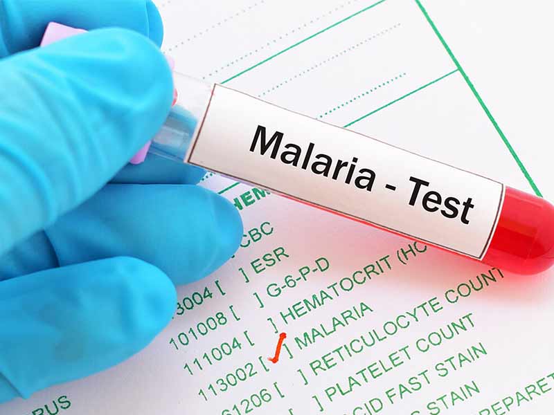 علائم مالاریا چیست