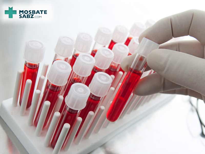 شرایط لازم قبل از انجام آزمایش خون چیست؟