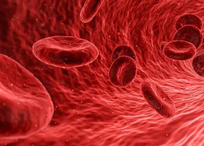 شایع ترین علائم کم خونی در زنان و مردان کدام است؟