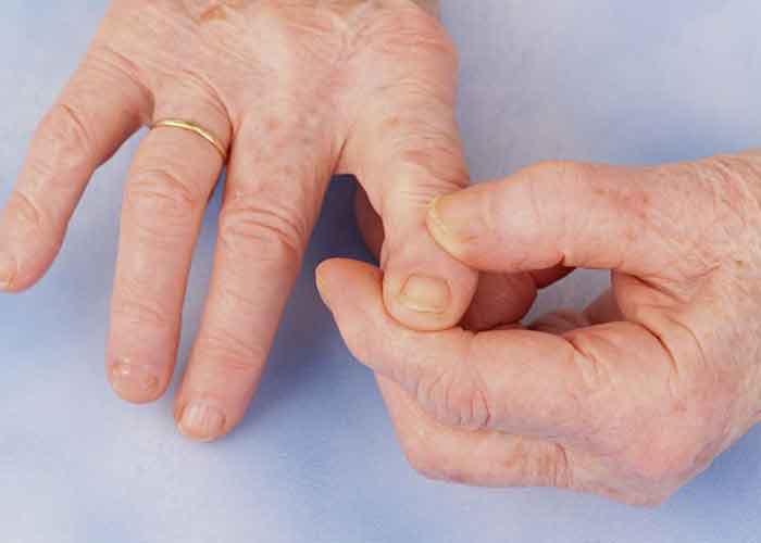  کپسول سلدرین و درمان آرتروز