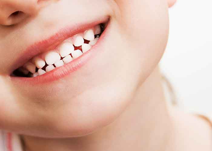 آیا شربت فروگلوبین دندان را سیاه می کند ؟