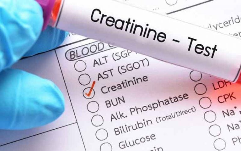 با دلایل و عوامل بالا رفتن کراتین کلیه آشنا شوید؟ علت بالا رفتن کراتین کلیه چیست؟