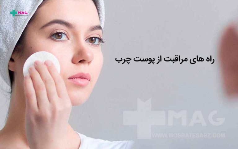 راه های مراقبت از پوست چرب