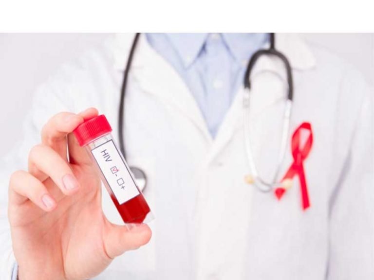 تفسیر آزمایش ایدز HIV