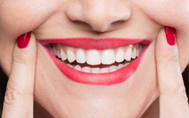 آشنایی با انواع روش های دندانپزشکی زیبایی