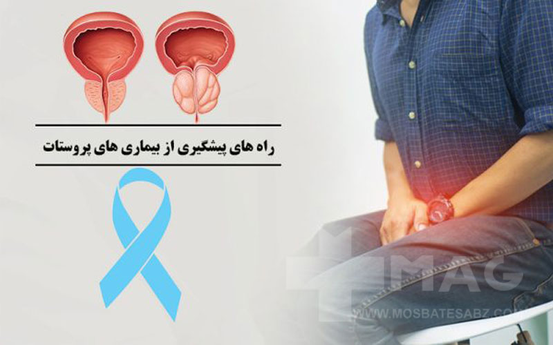 راه های پیشگیری و درمان پروستات کدام است؟