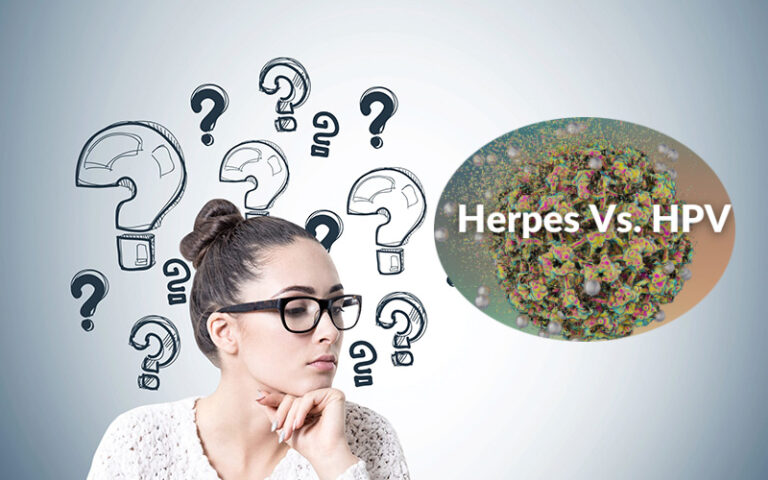 تفاوت زگیل تناسلی و تبخال تناسلی