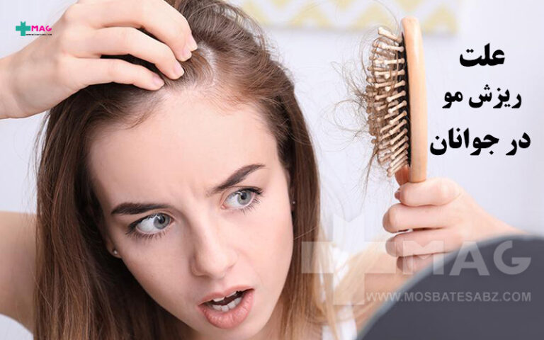 علت ریزش مو در جوانان