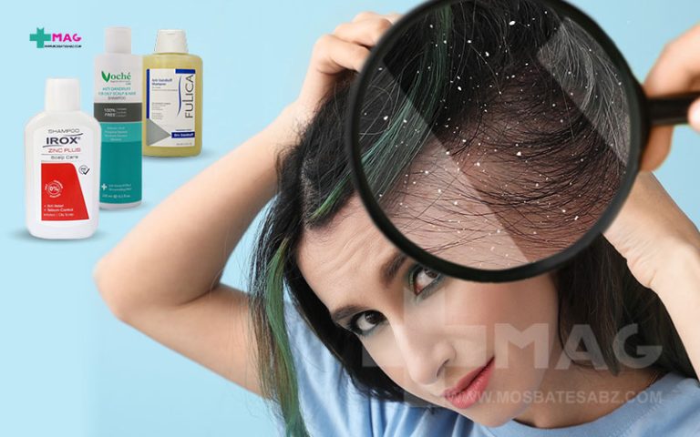 بهترین شامپو ضد شوره