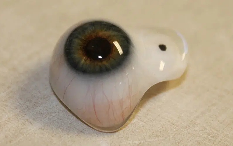 0تا100 پروتز چشم [تخلیه چشم+قیمت پروتز چشم مصنوعی]