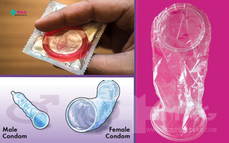 تفاوت کاندوم زنانه و مردانه