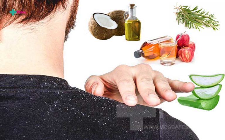 بهترین درمان خانگی رفع شوره سر