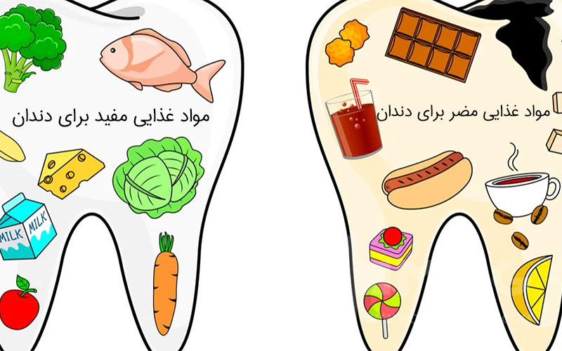 مواد غذایی مفید و مضر برای دندان