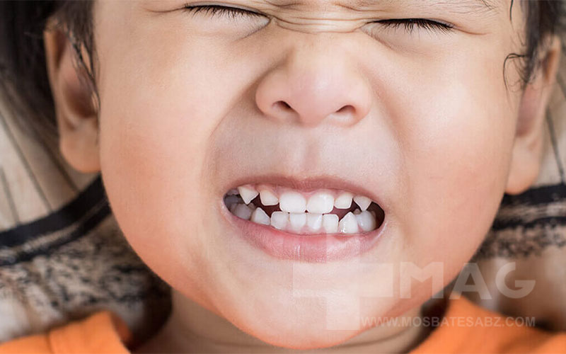 دندان قروچه کودکان در خواب