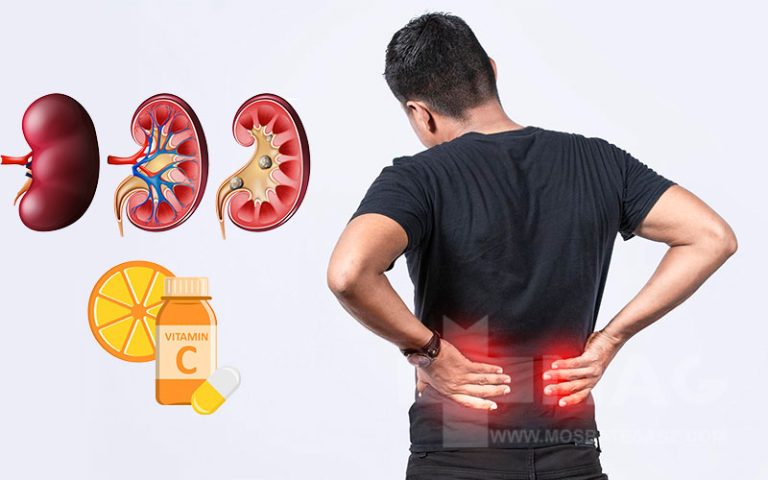 مصرف این ویتامین شما را دچار سنگ کلیه می کند