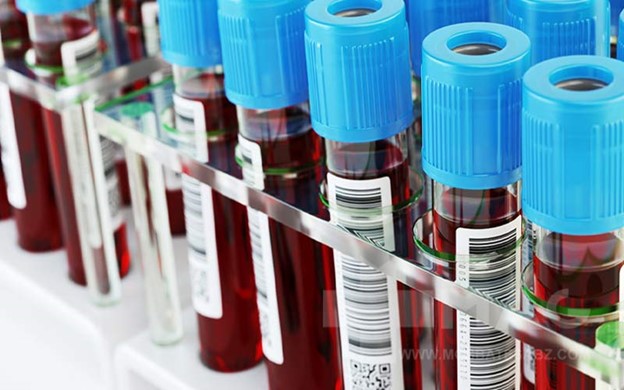 تشخیص 18 نوع سرطان با نسل جدید آزمایش خون