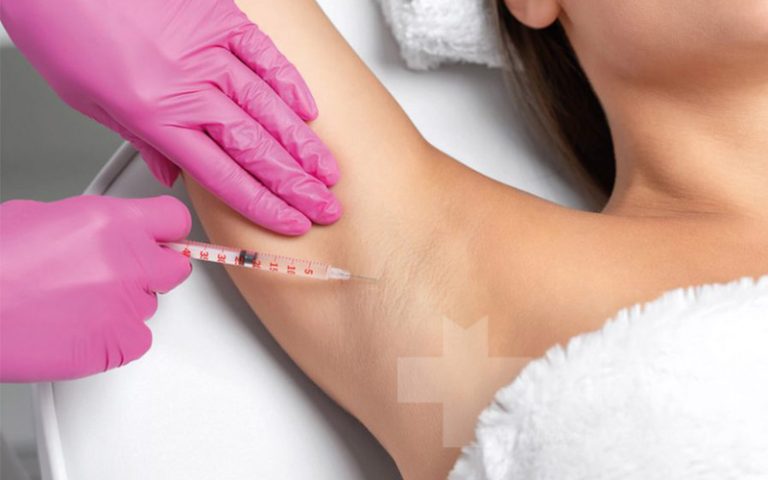 بوتاکس زیر بغل