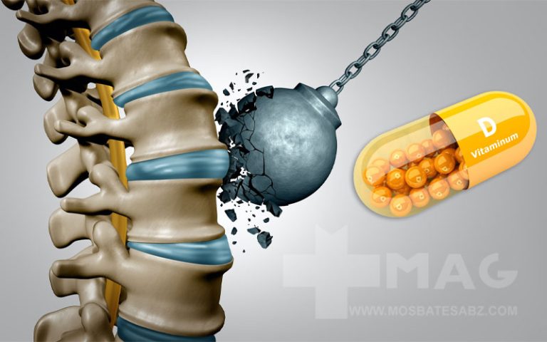 ویتامین دی و تقویت استخوان