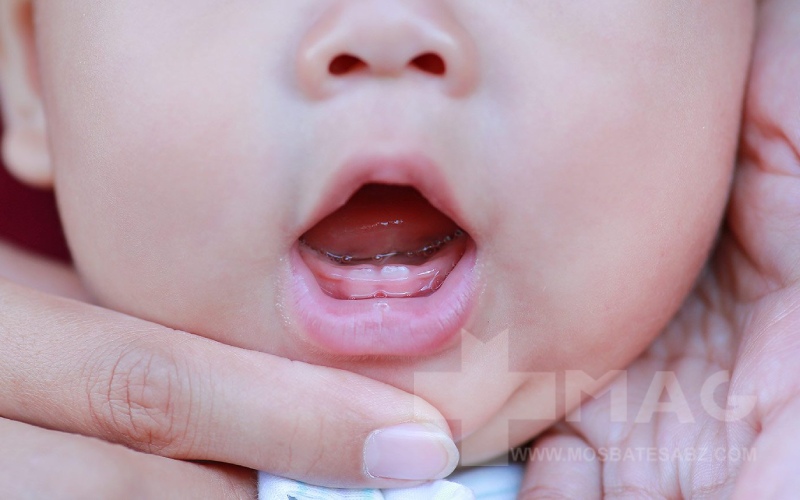 مراقبت‌های اورژانسی دندان درآوردن نوزاد