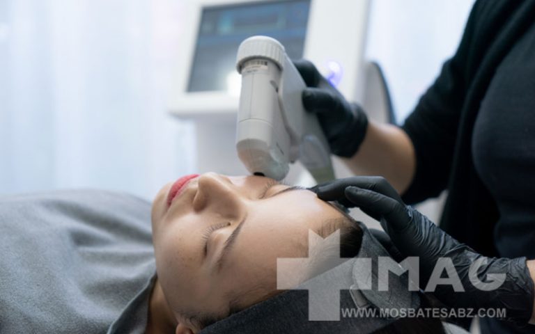 هایفوتراپی دور چشم