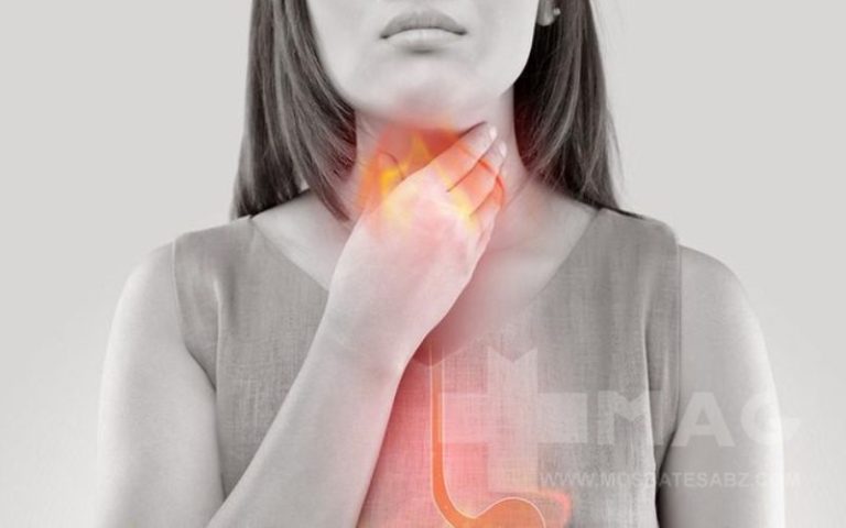 رفلاکس اسید