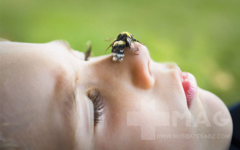 حساسیت به نیش زنبور عسل