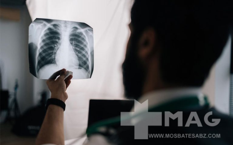 علائم سرطان ریه