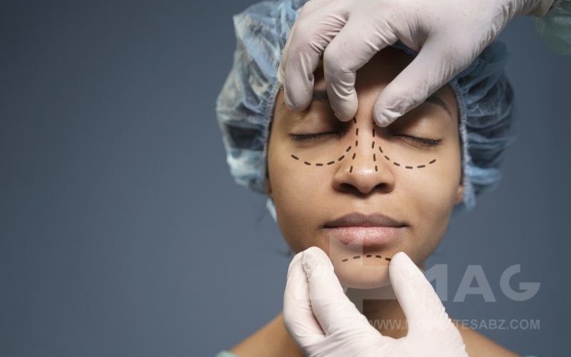 روش‌های جراحی بینی