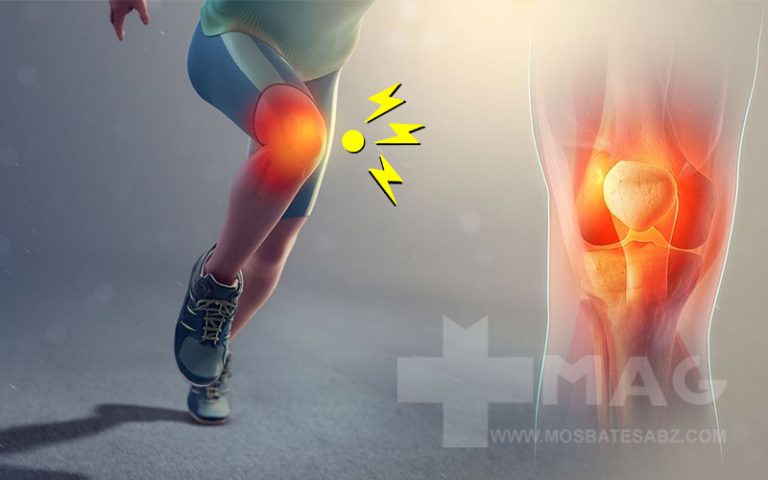 کمبود کدام ویتامین باعث صدا دادن مفاصل می شود؟