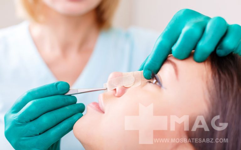 مراقبت های بعد از عمل بینی