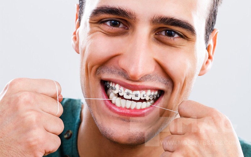 عوامل بیماری بر طول دوره درمان با دندان ارتودنسی