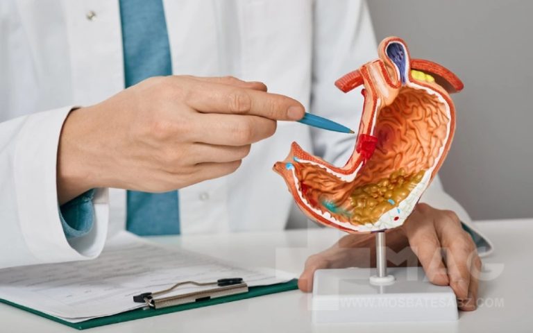 پولیپ کیسه صفرا