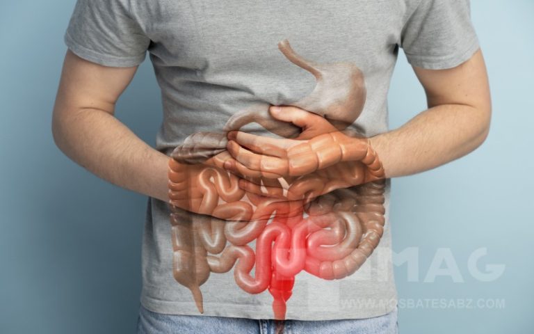 پولیپ معده چیست