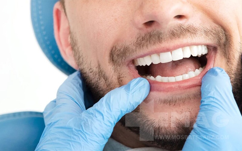 چه کسانی به ارتودنسی دندان نیاز دارند