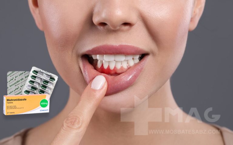 چرک خشک کن قوی برای عفونت لثه