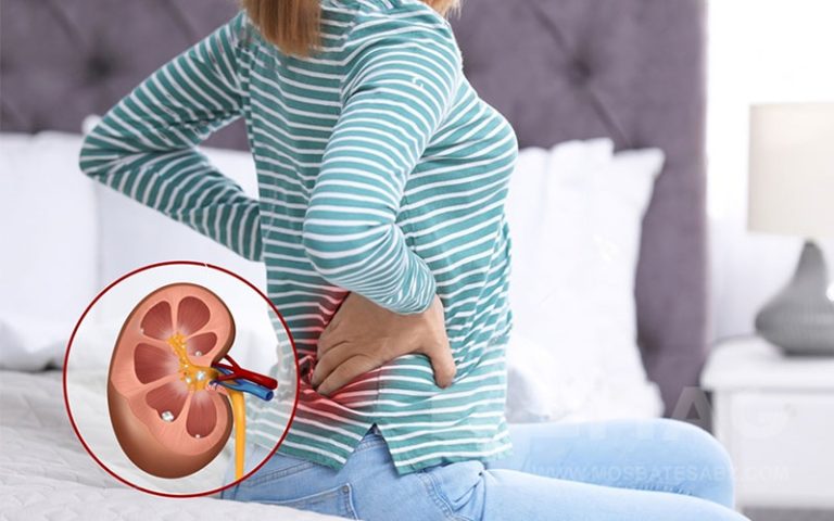 قویترین داروی گیاهی سنگ شکن کلیه