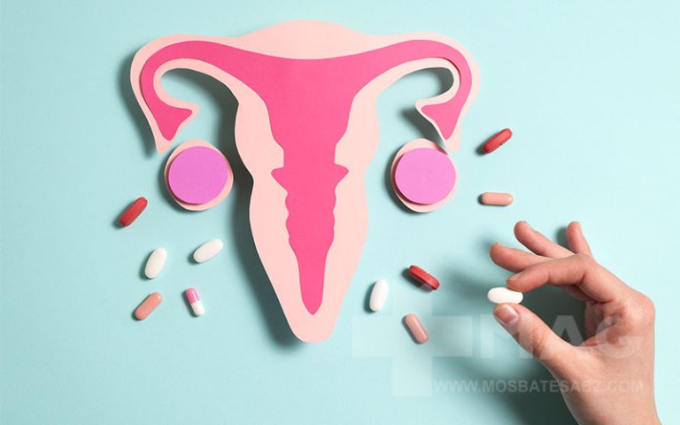 بهترین دارو برای کیست تخمدان