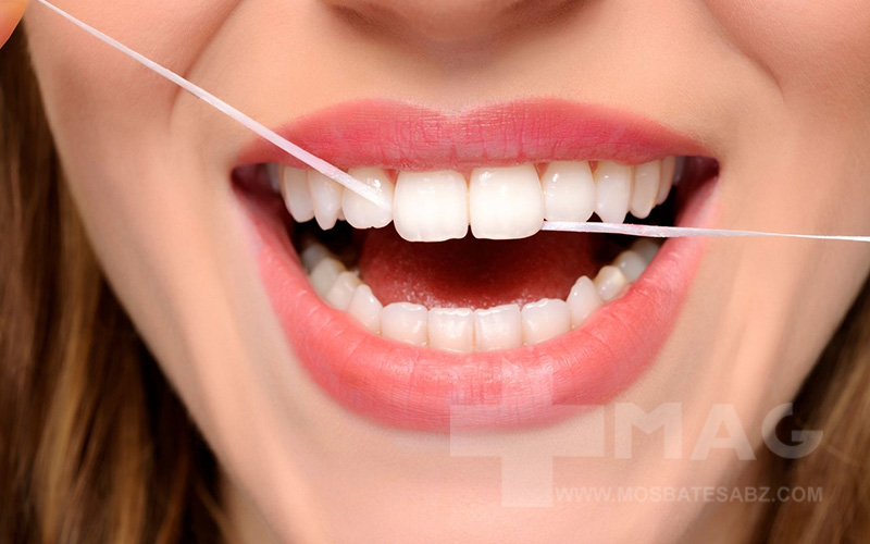 رعایت بهداشت دهان و دندان برای جلوگیری از عفونت لثه