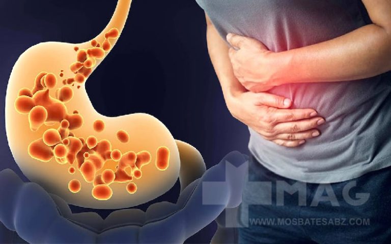 برای درمان رفلاکس معده چی بخوریم؟