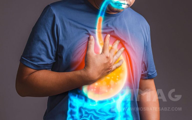 سریع ترین روش درمان رفلاکس معده در خانه