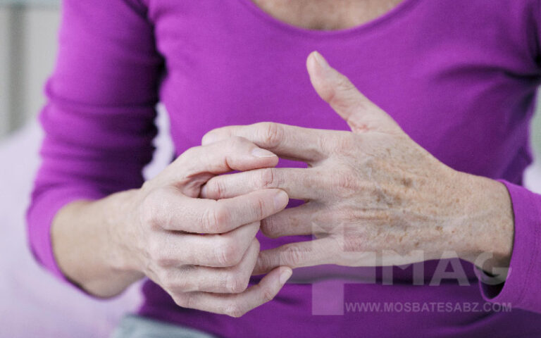 روماتیسم مفصلی