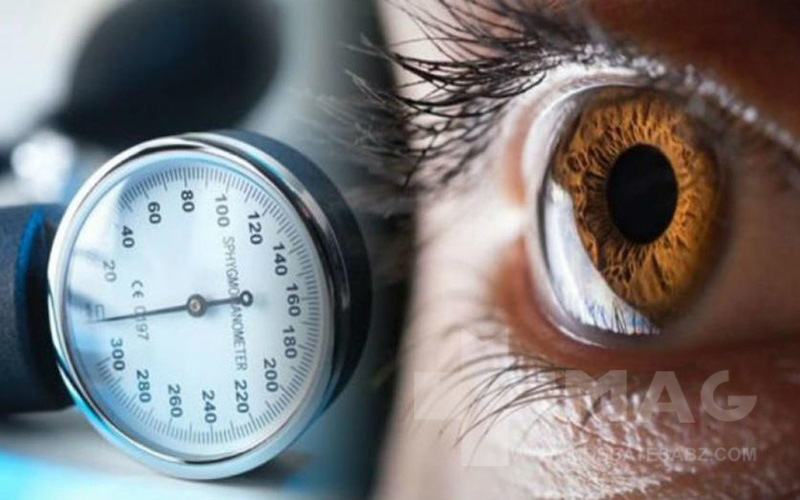 درمان فشار چشم