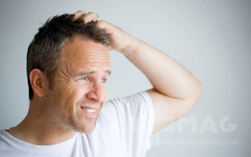 علت خارش سر