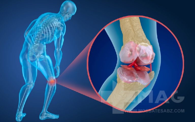 چه میوه ای برای روماتیسم خوبه