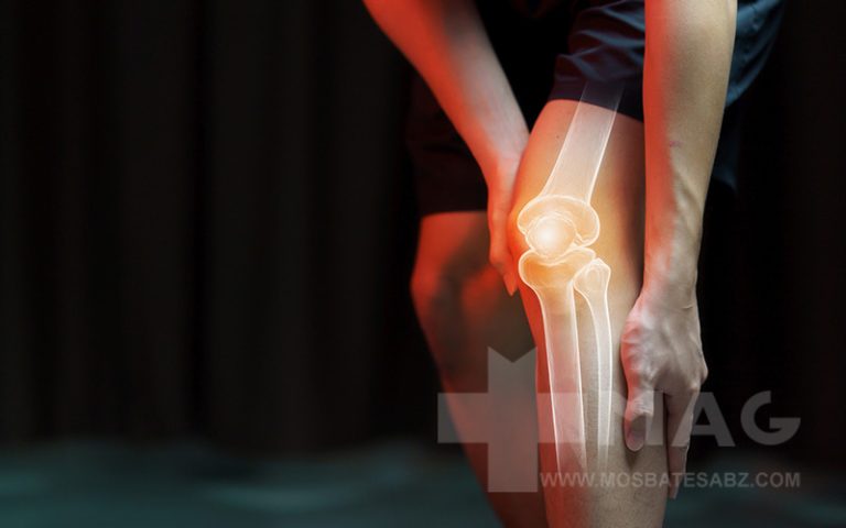 علت درد زانو چپ