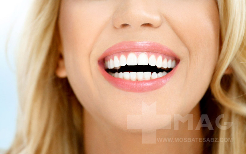 دندان چیست؟ انواع دندان و عملکرد آن