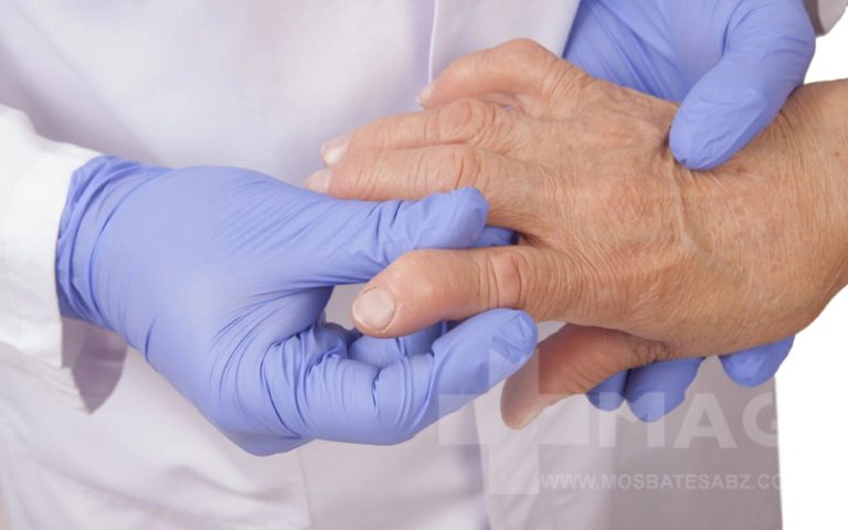 درمان روماتیسم چیست؟